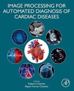 دانلود کتاب Image Processing for Automated Diagnosis of Cardiac Diseases دانلود کتاب Image Processing for Automated Diagnosis of Cardiac Diseases